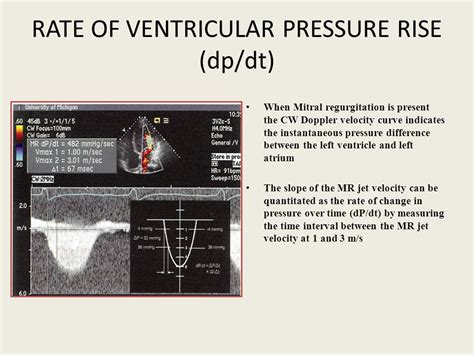 lv dp dt normal values